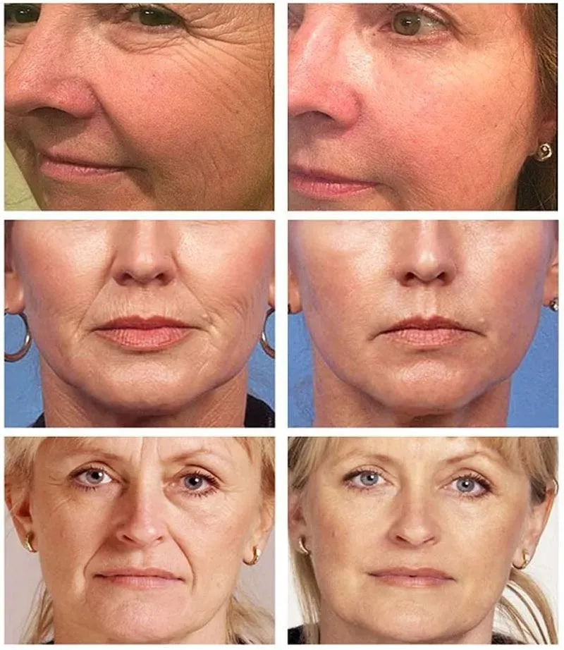 Collagen Wrinkle Remover Face Serum